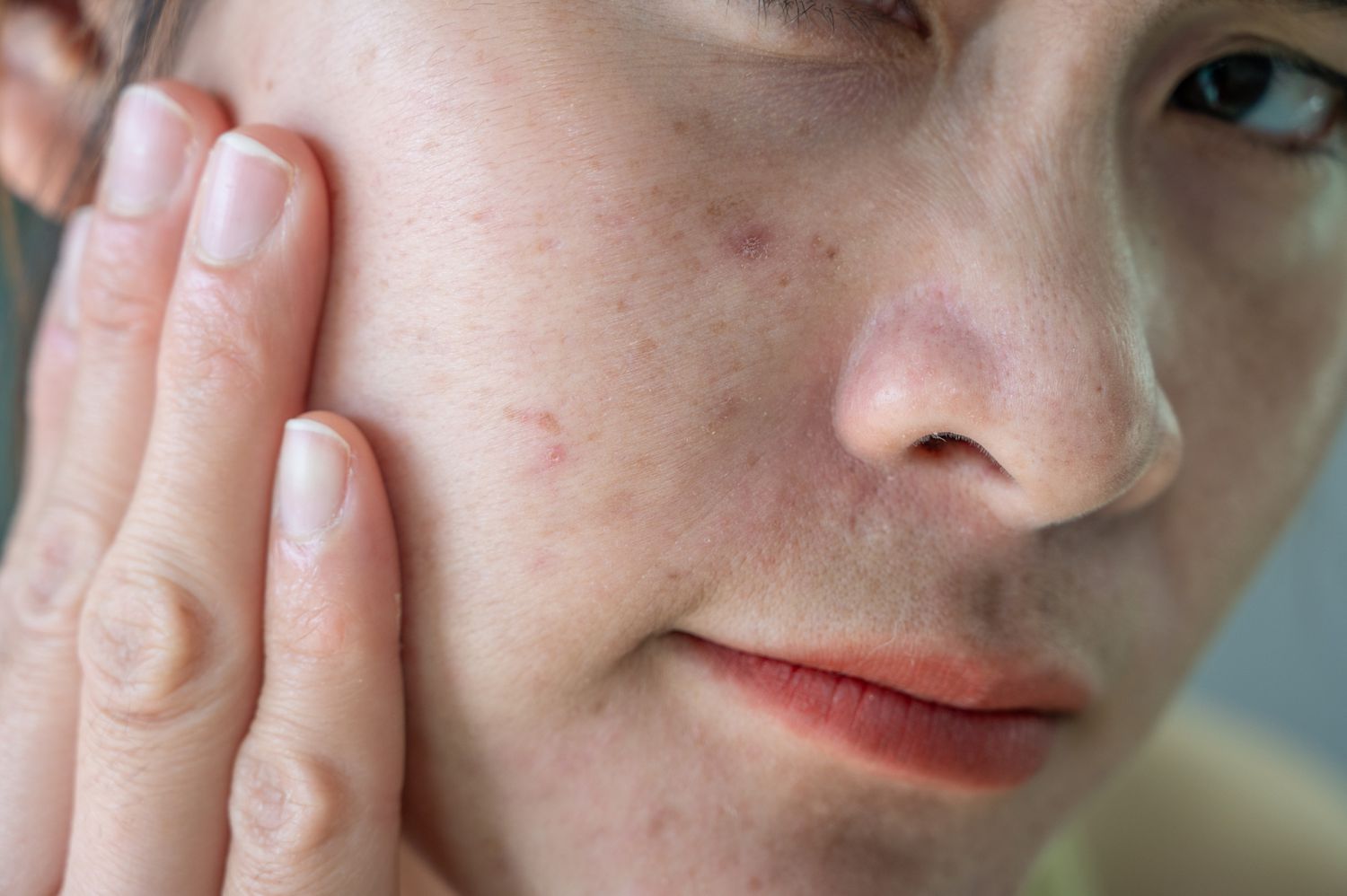 Close-up of healthy skin texture focusing on clarity and smoothness.