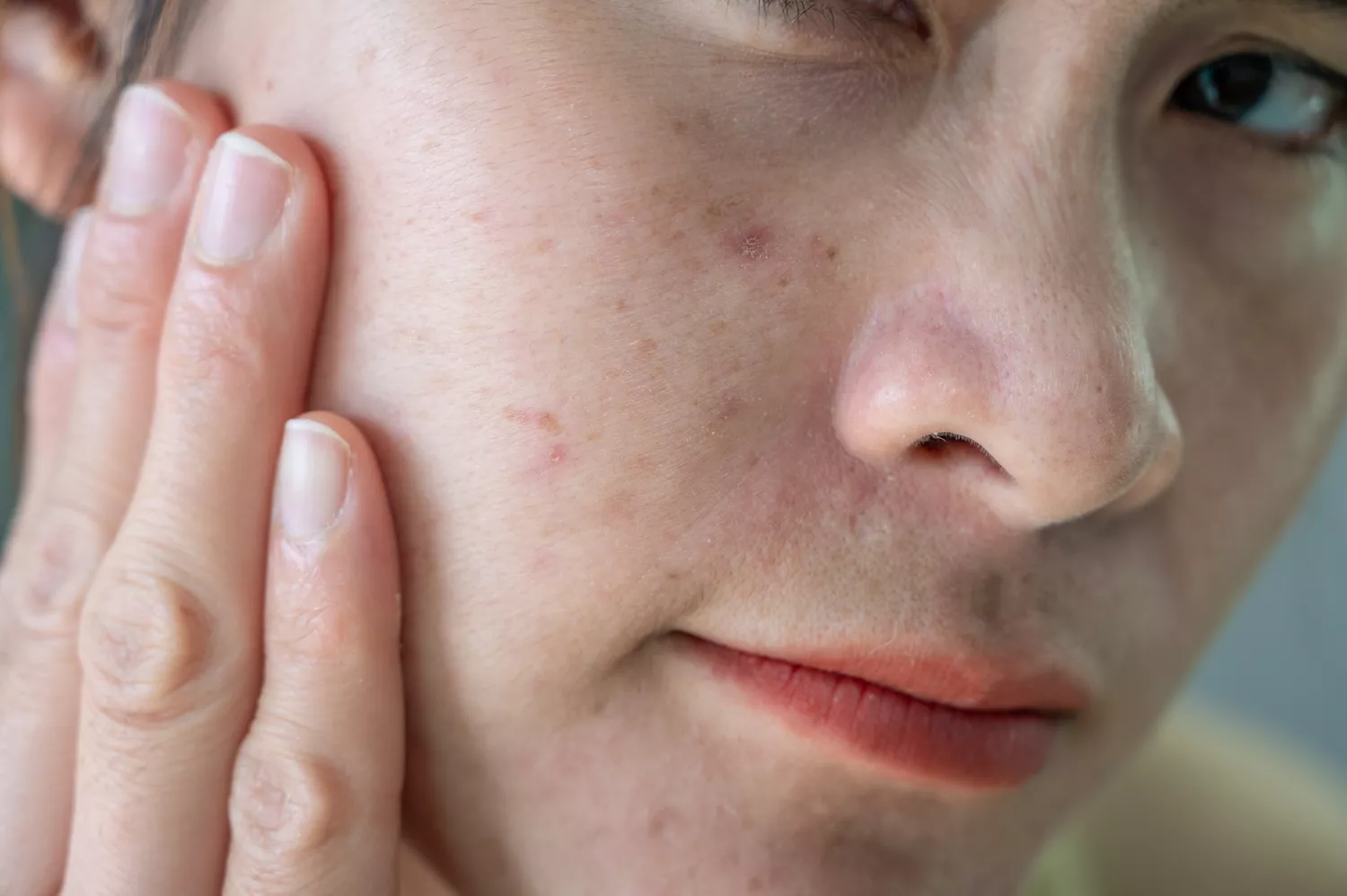 Detailed close-up of a person's facial skin and profile.