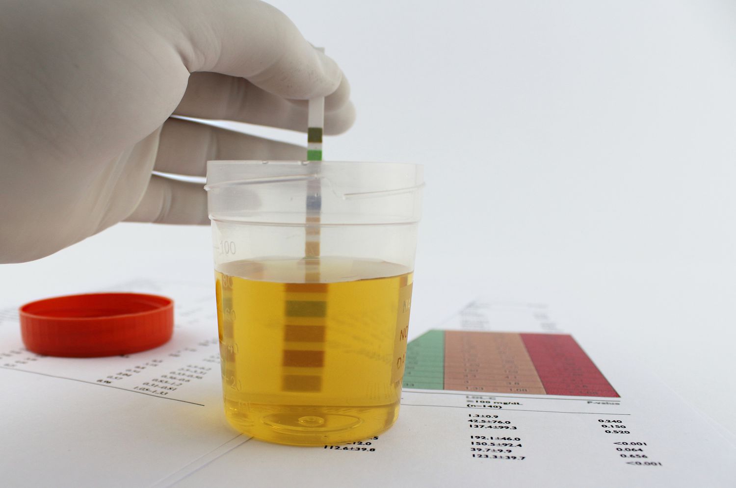 A medical professional performing a urine dipstick test in a laboratory to check diagnostic markers.